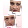 Whitening Crema facial aclarante